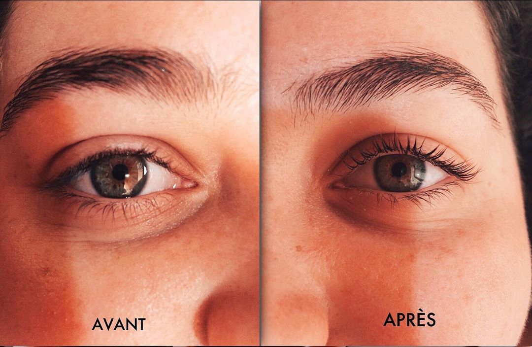 Comparaison avant et après sur un œil brun démontrant l'efficacité du traitement, soulignant des cils plus fournis et un regard revigoré.
